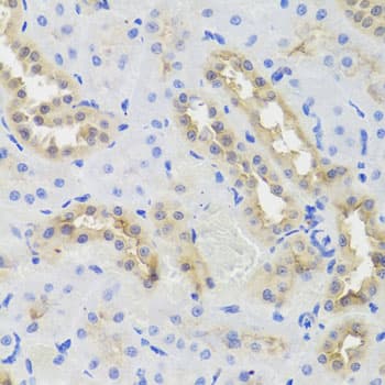 DISC1 Antibody