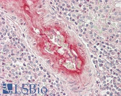 IHC-plus™ Complement C9 Antibody (aa181-230)