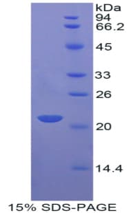 Rat APOD / Apolipoprotein D (Recombinant His)