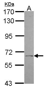 UGT1A9 Antibody (aa291-530)