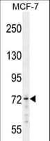 MED25 Antibody (aa112-140)