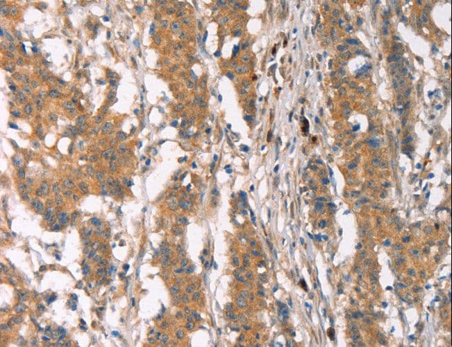 PLIN2 / ADFP / Adipophilin Antibody