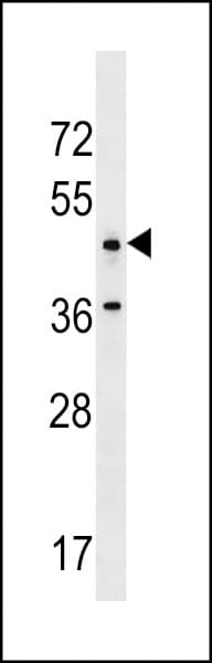 ANKRD61 Antibody (aa370-397)