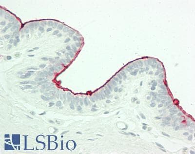 IHC-plus™ Monoclonal Mouse anti-Human CA 15-3 Antibody (IHC, WB)