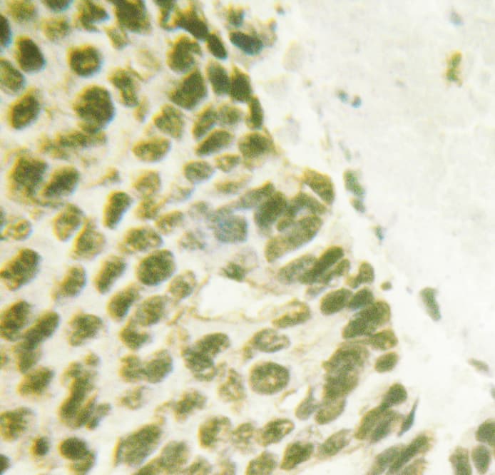 Polyclonal Rabbit anti-Human FANCD2 Antibody (phospho-Ser222, IHC, IF, WB)
