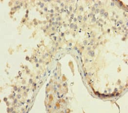 Polyclonal Rabbit anti-Human HMGB4 Antibody (aa1-186)