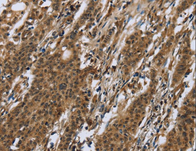 RAP1B Antibody