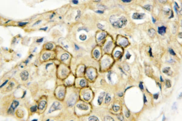 Polyclonal Rabbit anti-Human CD9 Antibody (Tyr129, IHC, IF, WB)