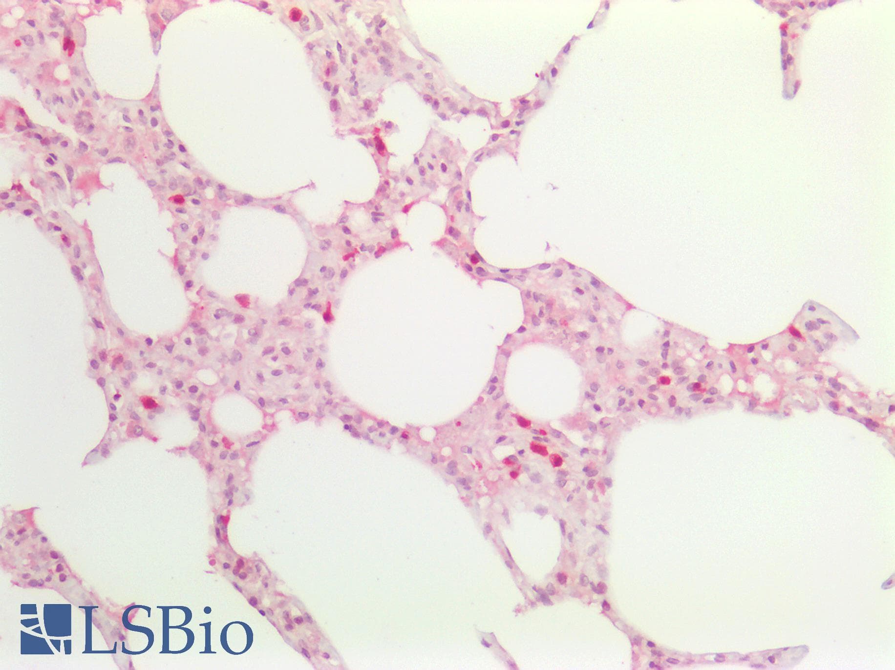 PathPlus™ EIF4EBP1 / 4EBP1 Antibody (aa30-79)