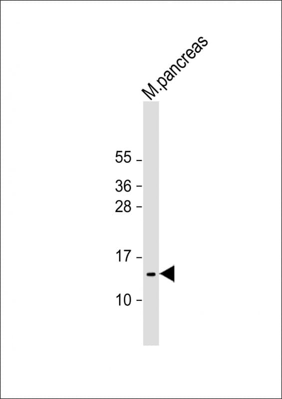 POLR2F Antibody (N-Terminus)