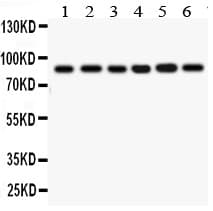 IKBKB / IKK2 / IKK Beta Antibody (aa588-604)