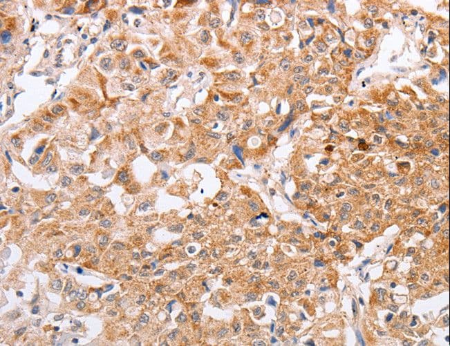 PPP1CB Antibody