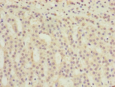 TMEM31 Antibody