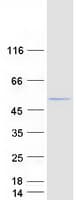 Human ABHD2 Protein (Recombinant Myc-DDK (Flag))