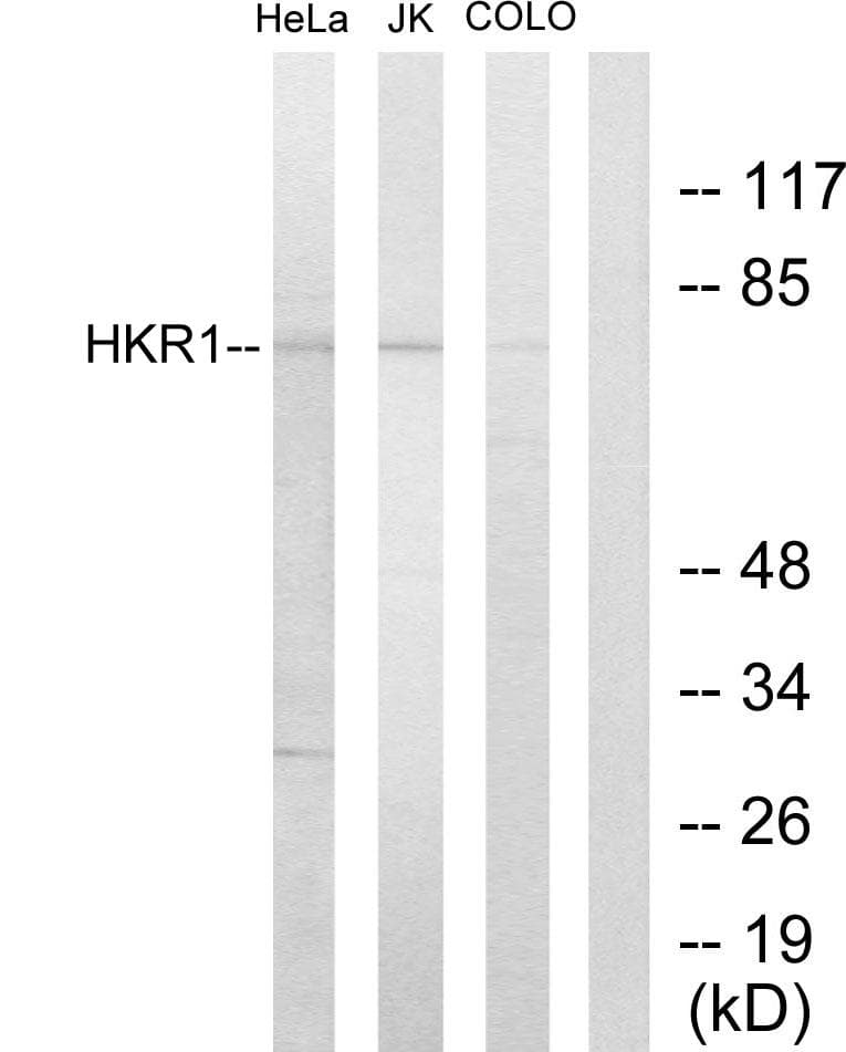 HKR1 Antibody