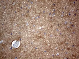 VILIP / VSNL1 Antibody (clone OTI2H3)