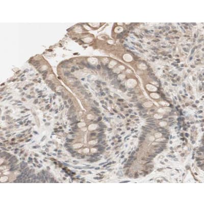 PRKAA1 / AMPK Alpha 1 Antibody (phospho-Ser485,pSer491)