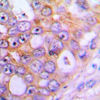 Polyclonal Rabbit anti-Human CHML Antibody (Internal, IHC, WB)