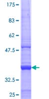 Human MBTPS1 / S1P Protein (Recombinant GST, N-terminus)