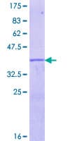 Human EGR4 / EGR-4 Protein (Recombinant GST, N-terminus)