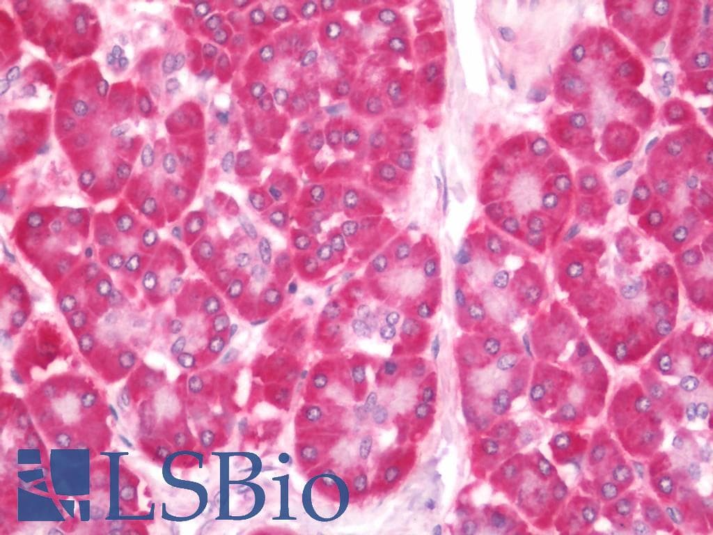 IHC-plus™ CTDSP1 / SCP1 Antibody (aa1-50)