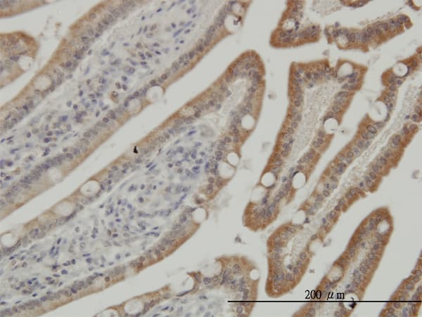 Monoclonal Mouse anti-Human CSNK1G1 / CKI-Gamma 1 Antibody (clone 3D1, IHC, WB)