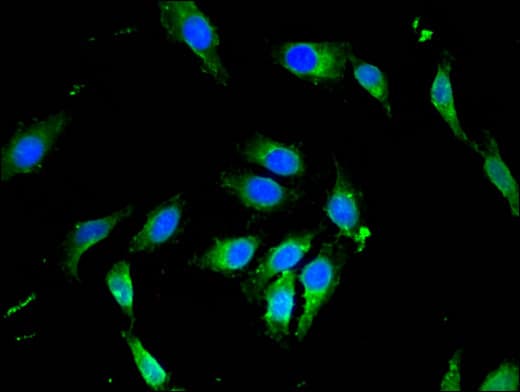 Polyclonal Rabbit anti-Human PIK3R4 Antibody (IHC, IF)