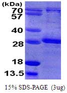 Human RHOB Protein (Recombinant His)