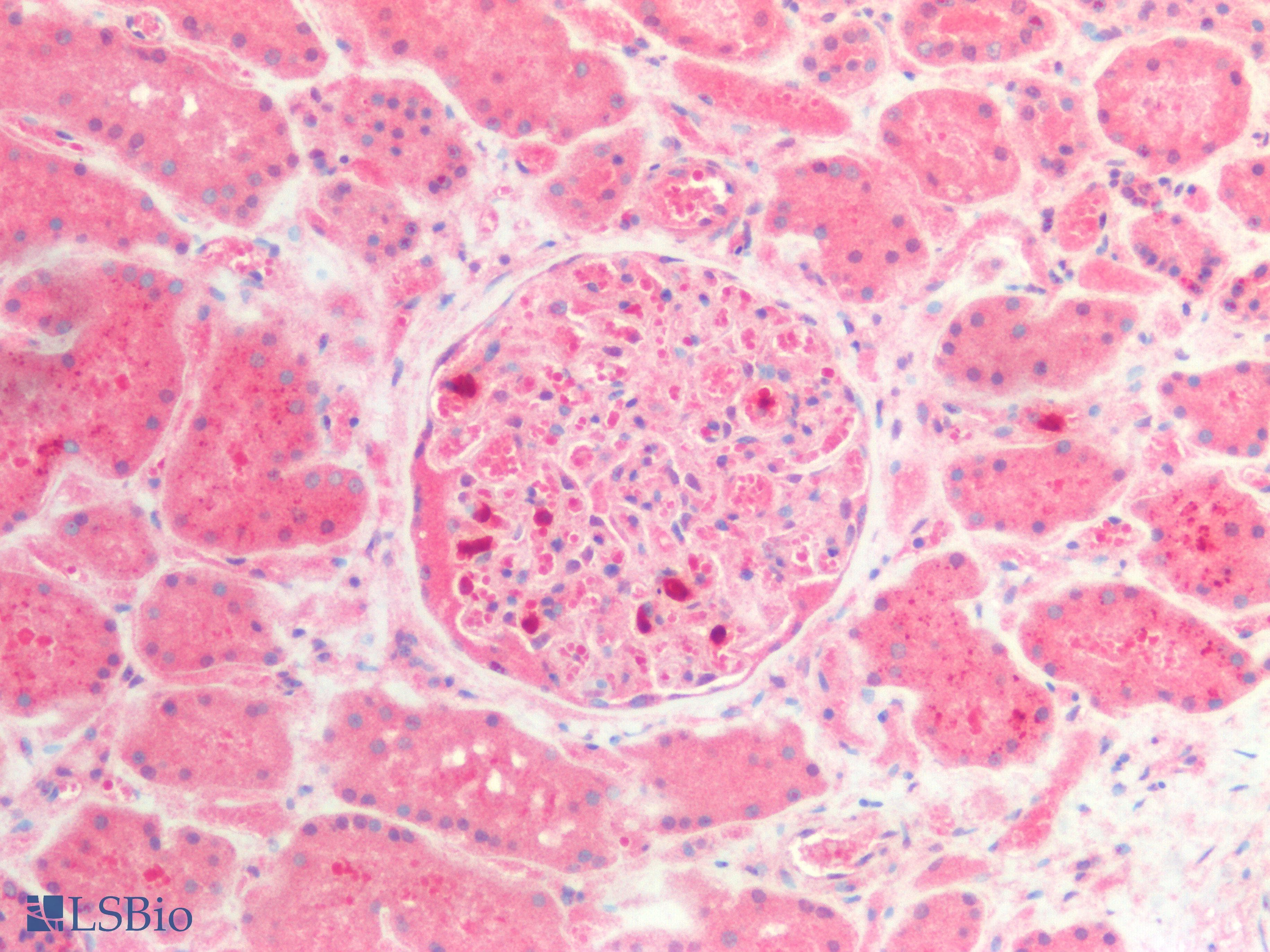 Polyclonal Rabbit anti-Mouse LAMC3 / Laminin Gamma 3 Antibody (aa1250-1418, IHC, WB)