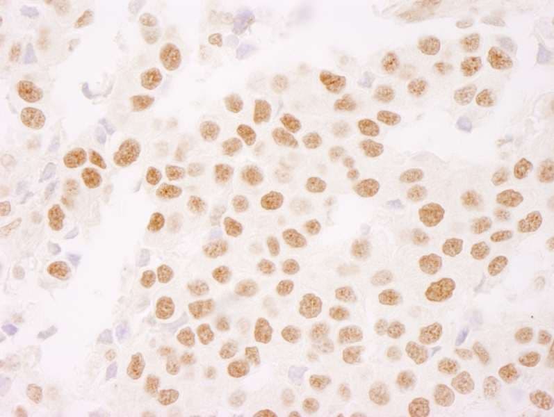MKI67 / Ki67 Antibody (aa1800-1850)