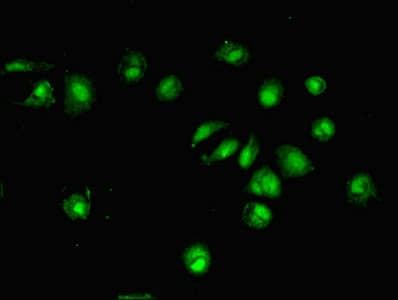 IHC-plus™ DTWD1 Antibody