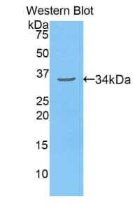 MYH3 Antibody (aa1593-1848)