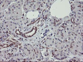 RBPMS / Hermes Antibody (clone OTI3B7)