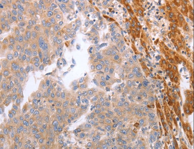 NRTN / Neurturin Antibody