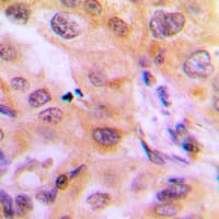 CYP2J2 Antibody (Internal)