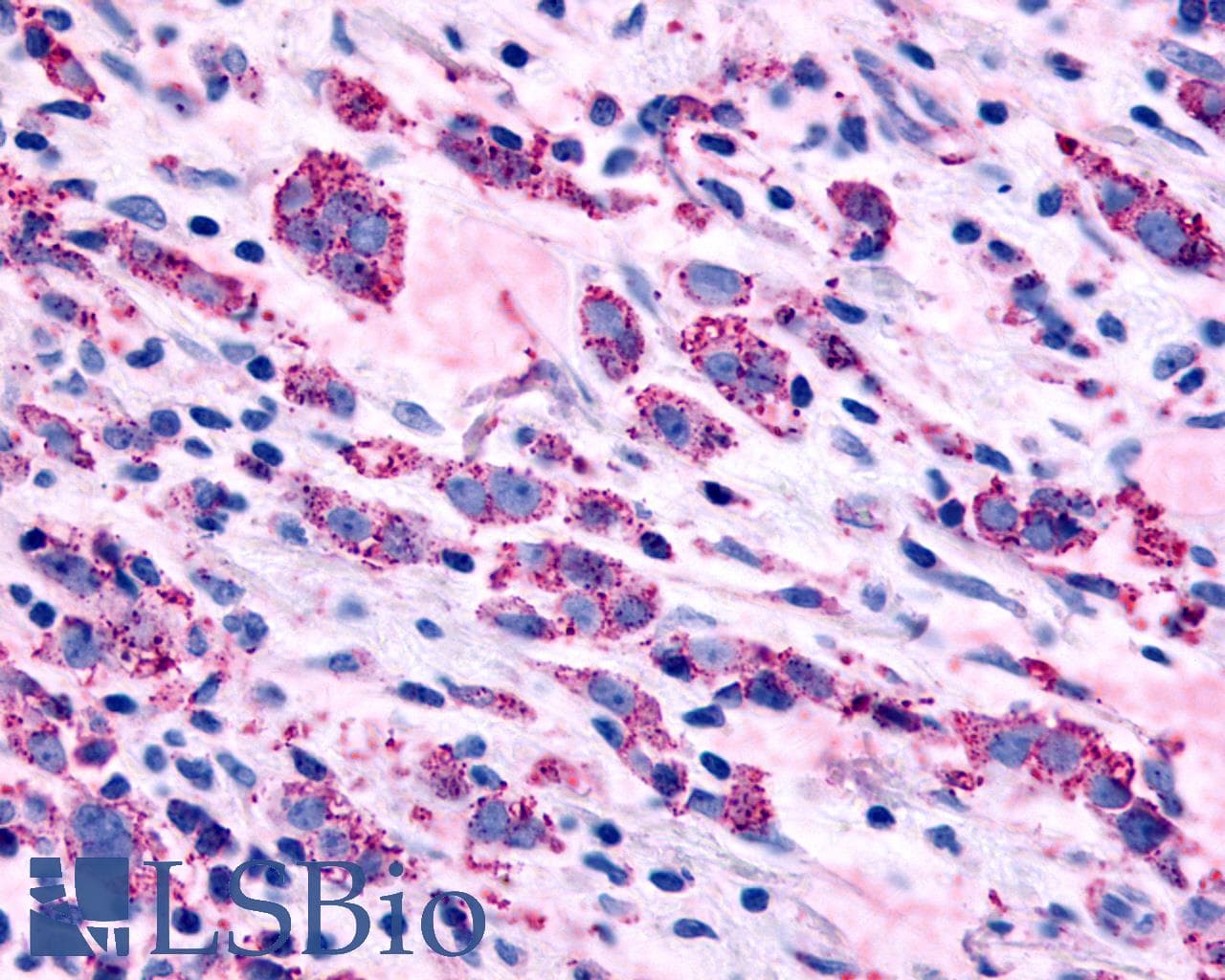 PathPlus™ Polyclonal Rabbit anti-Human ADRA1B / Adrenoceptor alpha 1B Antibody (Cytoplasmic Domain, IHC)