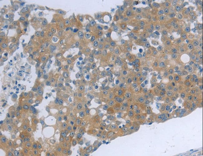 TNK2 / ACK1 Antibody