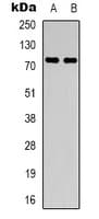 Polyclonal Rabbit anti-Human PRPF39 Antibody (Internal, IHC, WB)