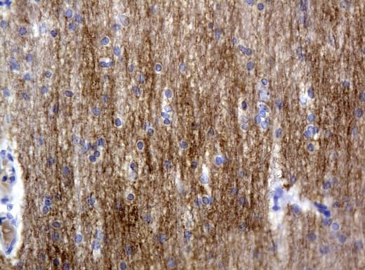 Monoclonal Mouse anti-Human L1CAM Antibody (clone UMAB48, IHC, IF, WB)