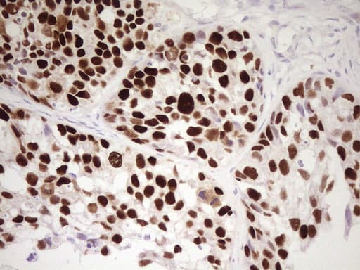 TP53 / p53 Antibody (clone UMAB206)