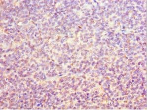 Polyclonal Rabbit anti-Human ORC6 / ORC6L Antibody (aa1-252, IHC, WB)