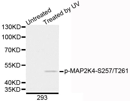 Polyclonal Rabbit anti-Human MAP2K4 / MKK4 Antibody (AP, phospho-Ser257/Thr261, WB)
