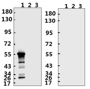 SARS-CoV-2 Nucleoprotein Antibody (aa 284-300)
