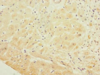 GP1BB / CD42c Antibody