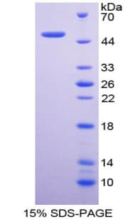Mouse DLK1 / Pref-1 Protein (Recombinant His-GST)