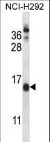 CNIH1 / CNIH Antibody (aa76-104)