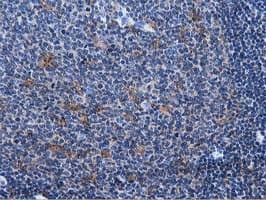 MICAL1 / MICAL Antibody (clone OTI6H4)