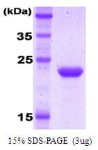 Human KIR2DL1 / CD158a Protein (Recombinant)
