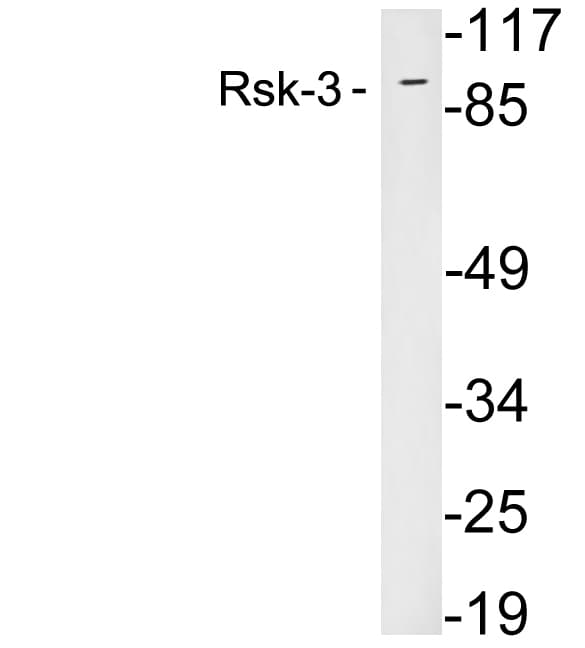 RPS6KA2 / RSK3 Antibody (aa304-353)