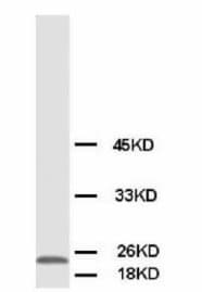 PMVK Antibody (Internal, Magnetic beads)
